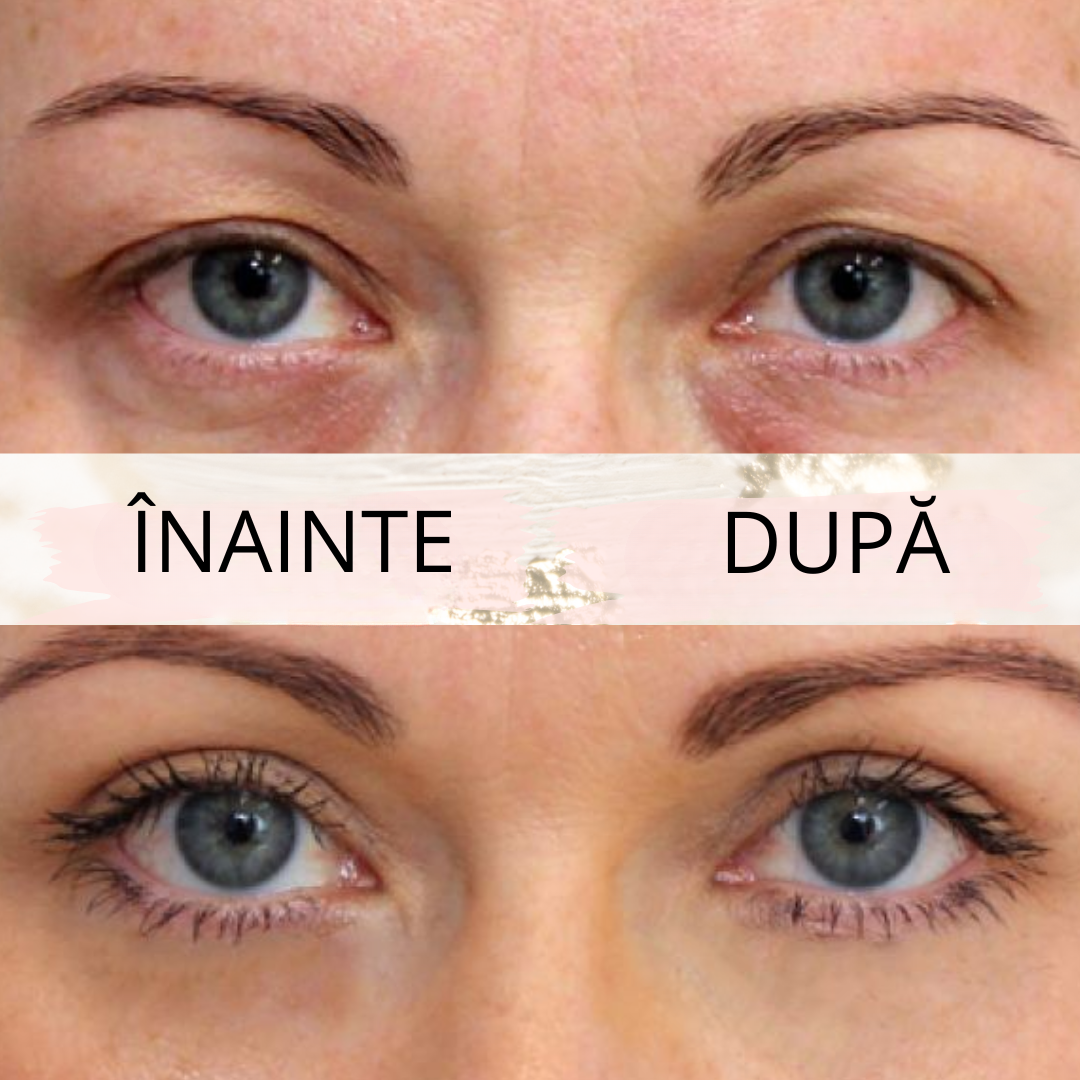 Eyelid PushUp 🤩 Privire Instantanee ✨ 120 Perechi! 😱