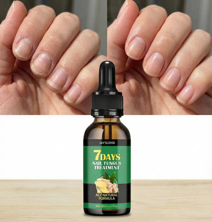 NailCare - Ulei Natural Pentru Îngrijirea Unghiilor