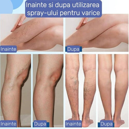 VenoRelief - alinare imediată pentru picioare